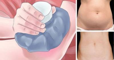 Want To Burn Fat Cells Easily? Try To Freeze Them.