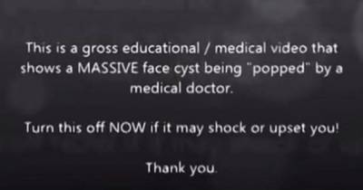 WATCH: You Will NOT Believe How Much Pus Comes Out Of This Man's Massive Face Cyst