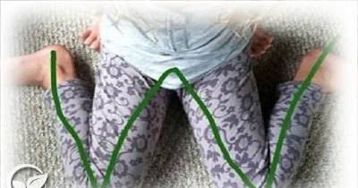 If You See Your Children Sitting In This &ldquo;W&rdquo; Position, Immediately Stop Them!