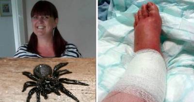 WARNING - GRAPHIC CONTENT: Woman Hospitalized TWICE In A Year After Horrific Spider Bites