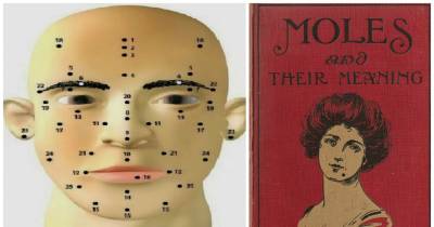 Moles On Your Face And What They Mean?