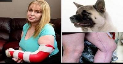 Mum's Arm Torn Open By Akita Dog In Terrifying Two-Hour Mauling Which Left Her With Horrifying Injuries
