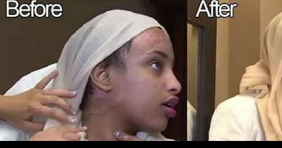 This Burn Victim Was Warned Not To Tattoo Her Face. But How She Looks Now Changes Everything!