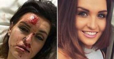 Woman 'Beaten To A Pulp By Man Outside Nightclub' After He Sent Her Chilling 'Behind You' Text