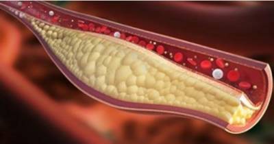 One Glass Of THIS Juice Everyday Will Unclog Your Arteries!