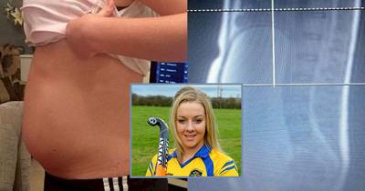 "Pregnant" Teen Girl Actually Has Large Tumor