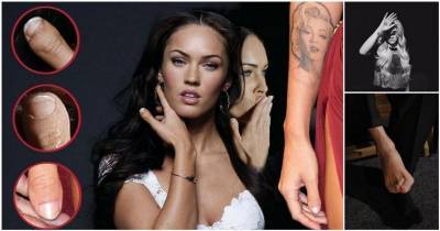Nobody's Perfect: Check Out These Famous Celebrities Imperfections!