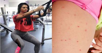 WARNING: Yoga Pants May Be Harming Your Body!