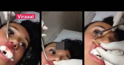 OMG! Girl Gets A Huge Worm Removed From Her Lip