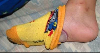 He Put Onions Into His Socks For One Fascinating Reason...