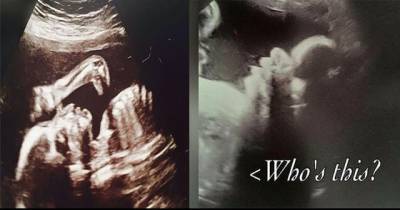 Chilling Picture Shows 'Demon' Watching Over Unborn Baby In Ultrasound Scan