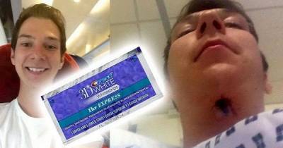 He Almost Died: He Wanted To Whiten His Teeth With This Product And Now He Has A Hole In His Throat
