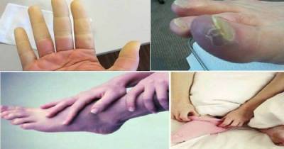 Reasons Why You Have Cold Feet And Hands, Which Reveal Some Serious Health Problems!