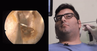 The TRUTH About What Is Hiding Inside Your Ear