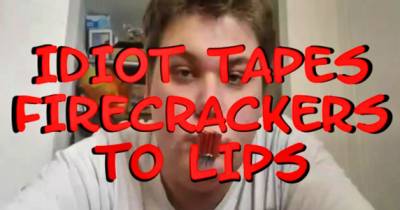 Kid Lights Firecrackers Taped To His Lips, Regrets His Decision Instantly