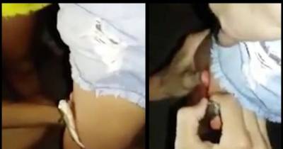 Gruesome Moment Fish Has To Be Pulled From Girl's Leg After Embedding Itself In Her Thigh