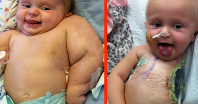 This 2 Year Old Girl Is Missing An Arm. Her Parents Didn&rsquo;t Know What Else She Was Missing.