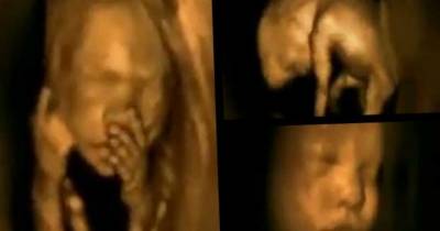 Amazing 4D Ultrasound Shows Baby Dancing In The Womb