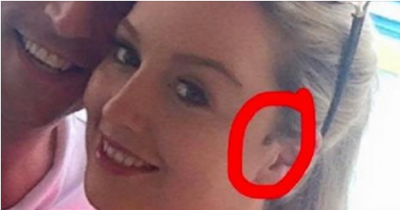 At First She Thought It Was A &lsquo;Pimple&rsquo; That Wouldn&rsquo;t Go Away. Her Mistake Was Trusting Her Doctor.