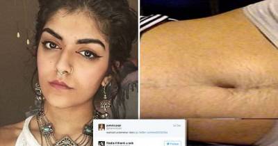 Woman With Stomach Hair Selfie Gets Criticized, Now She's Back Better Than Ever