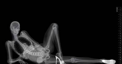 High-tech X-rays Help Make The Most Interesting Calendar You'll Ever See