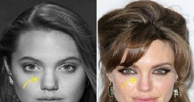 Celebs Who Claim They&rsquo;ve Never Had Plastic Surgery... But, Come On