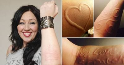 Bizarre: This Woman Is Allergic To Her Own Touch