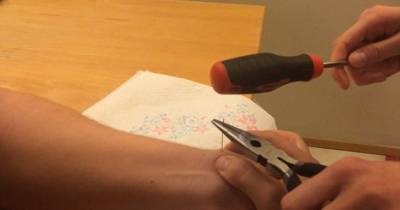 Guy Hammers Needle Into Wrist To Pop Giant Cyst