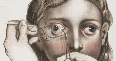 Terrifying Pictures That Reveal The Horror Of Surgery In The Victorian Era!