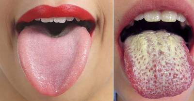 10 Secrets You Didn&rsquo;t Know Lie Inside Your Mouth