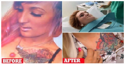 Bride-to-Be Has Six-Inch Tattoo Cut Off of Her Chest