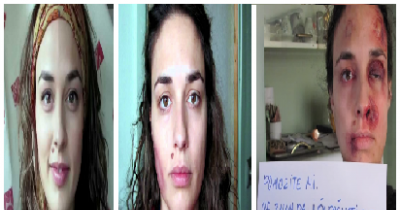 Woman Takes A Selfie Every Day To Document The Worst Year Of Her Life