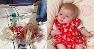 How A Sandwich Bag Saved Life Of A Premature Baby Will Give You Chills
