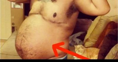 Every Day His Belly Got A Bit Bigger. But What They Find Is Unbelievable.
