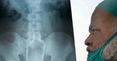 These X-rays Will Chill You Right Down To The Bone!