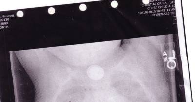 Baby Became Extremely Sick &ndash; No One Knew Why Until They Saw THIS Shocking X-Ray
