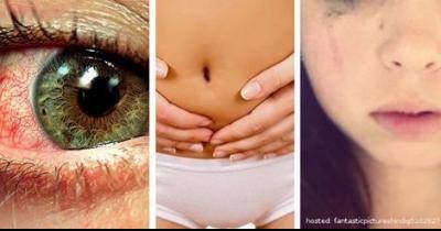 The Truth Behind Birth Control And It's Side Effects