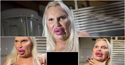 This Woman Spent $75000 For The &ldquo;Perfect Look&rdquo;. What She Got Instead Was A Nightmare! Through It All One Person Stuck By Her Side.