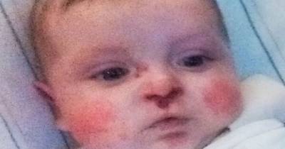 Biological Parents Abandon Twin Baby After Finding Out He Was Born With This