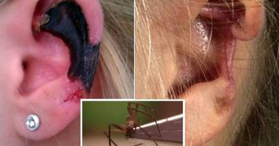 Spider 'Eats' Hole In Woman's Ear