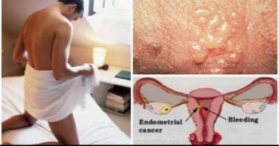 The Way To Find Out For Sure If You Already Have These 3 STDs
