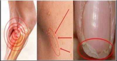 Have Acne, Hair Loss Or Frequent Headache? You Need To Find Out Why