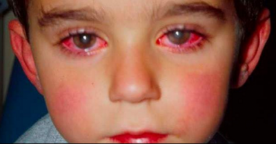 WARNING: A Child Lost 75% Of His Sight Because Of This Little Household Toy