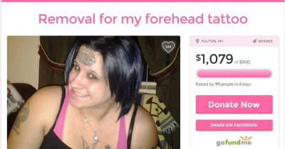 Girl Uses Forehead Tattoo Removal To Rip Off Go Fund Me Donations.