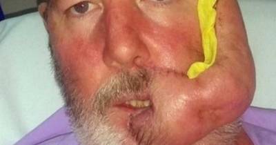 A Tiny Cold Sore Was The First Sign In The Devastating Chain Of Events That Changed A Man's Life