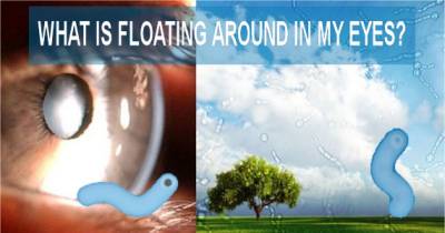 What Exactly Are Those Floaty Things In Your Eyes?