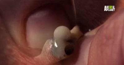 Mother Who Popped Bizarre Growth On Her Son's Leg Is Horrified To Find A SEA SNAIL Inside