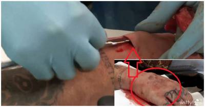 This Guy Has A 3D SKULL Implanted Into His Hand, The Video Is Breathtaking