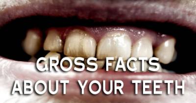 Really Gross Facts About Your Teeth