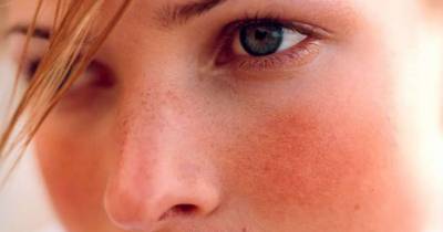 10 Signs Of Serious Health Problems That You Could Easily Miss